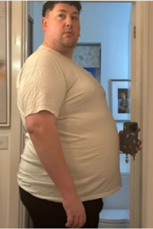 Before: Day 1 - Stephen, 35 kg lost in 12 months